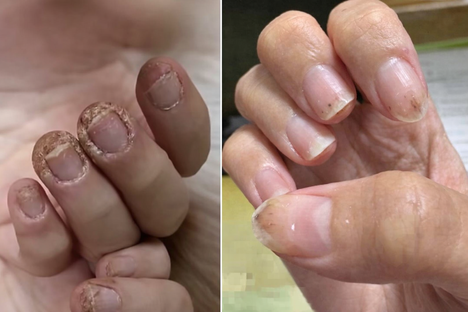 C&ocirc; g&aacute;i 28 tuổi m&oacute;ng tay 