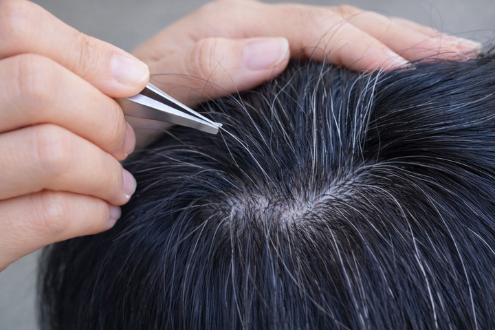 Một th&oacute;i quen phổ biến ai bị t&oacute;c bạc cũng l&agrave;m khiến t&oacute;c c&agrave;ng bạc, c&agrave;ng thưa- Ảnh 1.