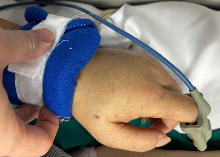 Bệnh viện Bạch Mai phát cảnh báo về 1 căn bệnh nguy hiểm, lây lan nhanh, tỷ lệ tử vong cao- Ảnh 1. Bệnh viện Bạch Mai phát cảnh báo về 1 căn bệnh nguy hiểm, lây lan nhanh, tỷ lệ tử vong cao- Ảnh 1.