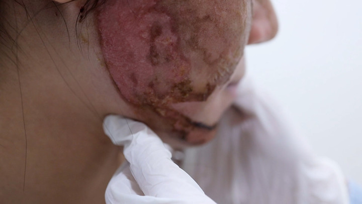 L&agrave;m đẹp cấp tốc, nhiều người 'tiền mất tật mang'- Ảnh 2.