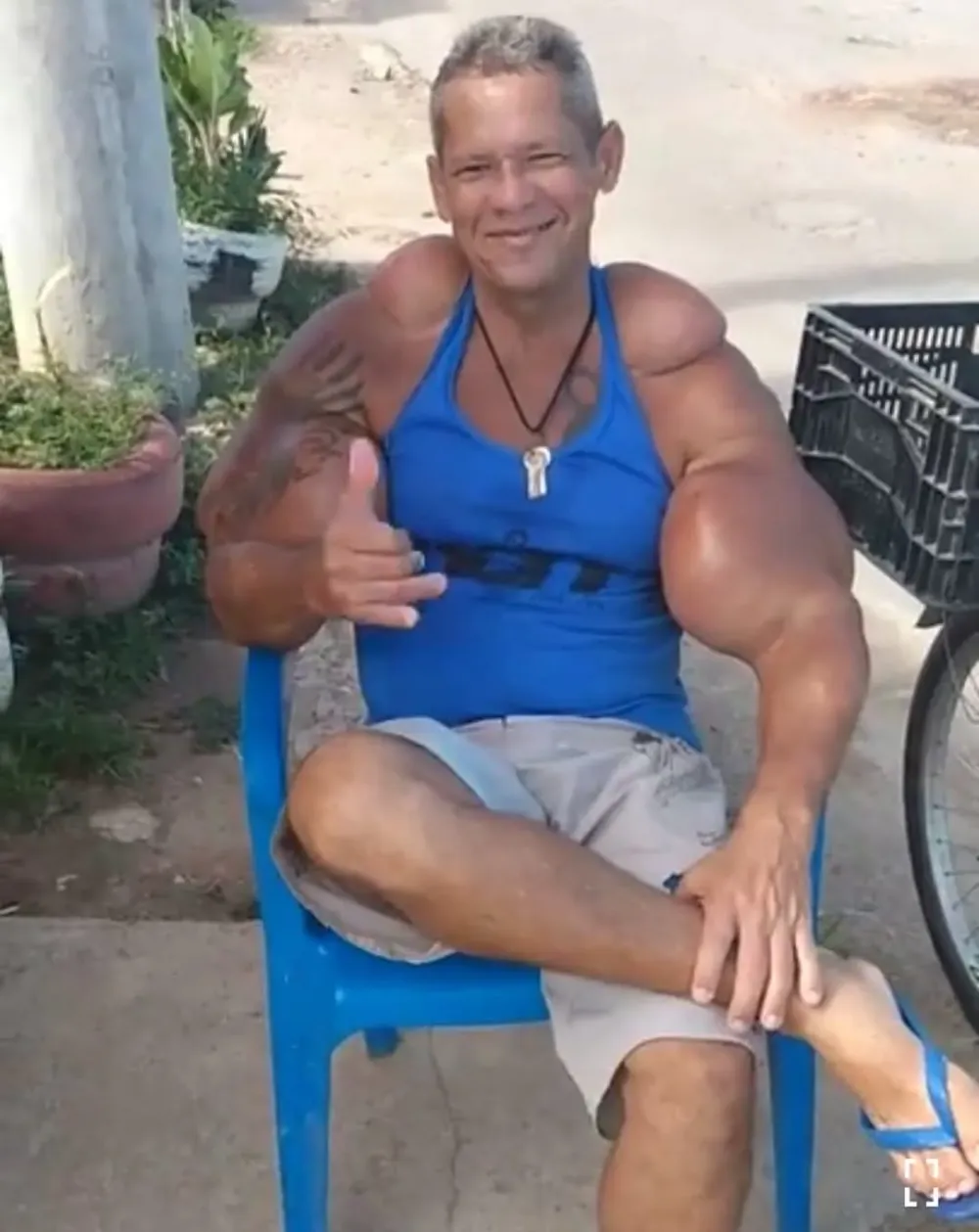 "Qu&aacute;i vật thể h&igrave;nh" Brazil sở hữu chu vi bắp tay l&ecirc;n tới 74cm đột ngột qua đời, b&aacute;c sĩ cảnh b&aacute;o 1 vấn đề sức khỏe tiềm ẩn- Ảnh 5.