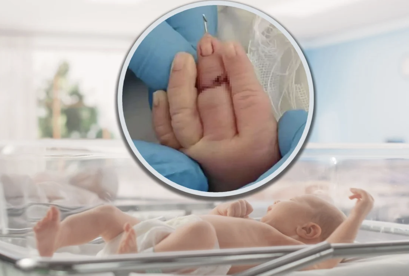 Cắt d&acirc;y rốn, nữ hộ sinh v&ocirc; t&igrave;nh cắt đứt ng&oacute;n tay trẻ sơ sinh: B&eacute; phải nối ng&oacute;n, gia đ&igrave;nh b&agrave;ng ho&agrave;ng- Ảnh 1.