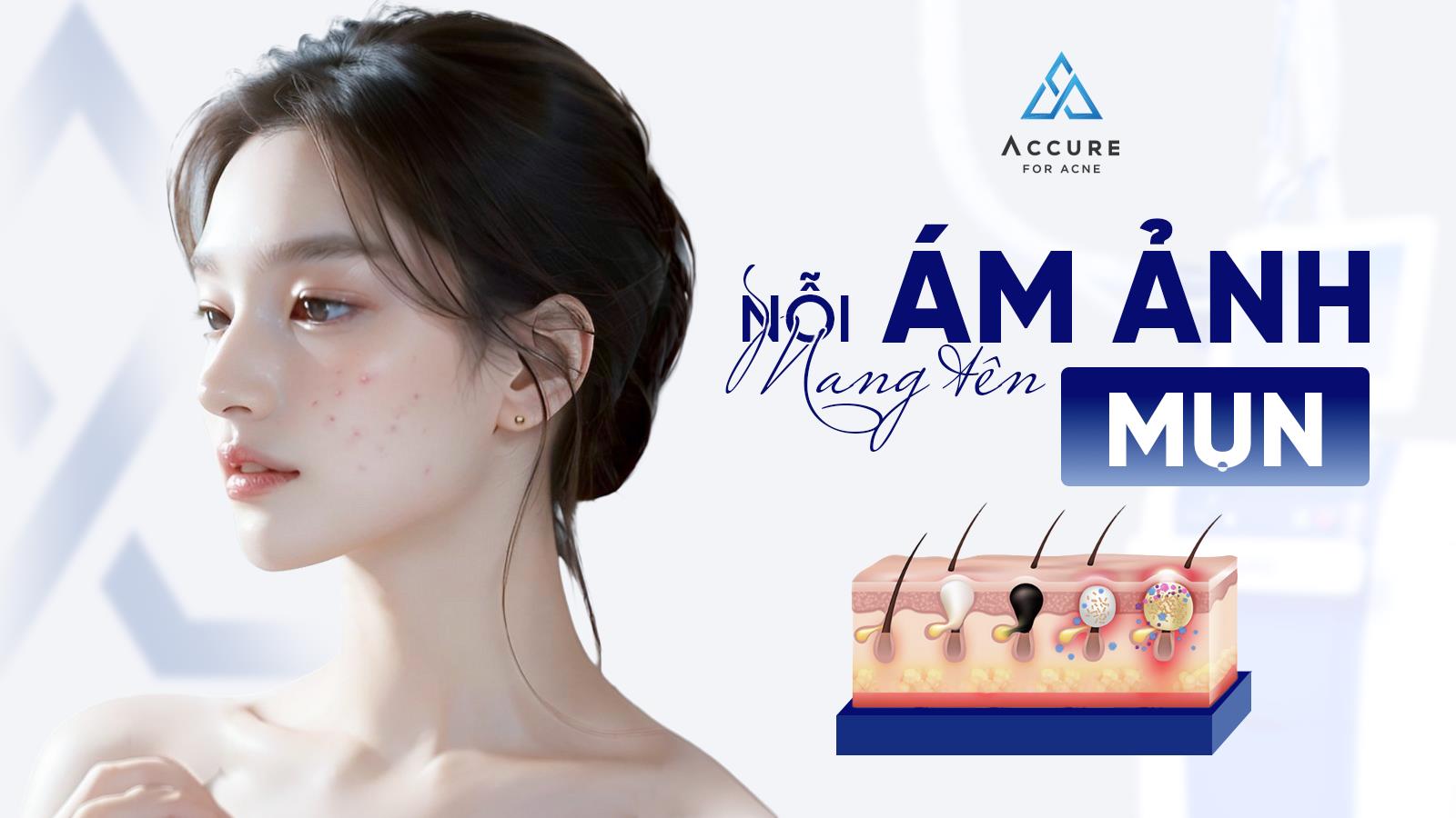 TRANFA ch&iacute;nh thức đưa c&ocirc;ng nghệ laser bước s&oacute;ng 1726nm ph&aacute; hủy tuyến b&atilde; Accure về Việt Nam- Ảnh 1.