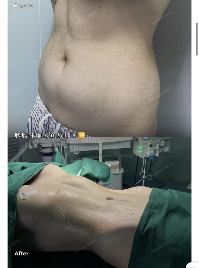 Xu hướng l&agrave;m đẹp kinh dị đang thịnh h&agrave;nh của mỹ nh&acirc;n - Ảnh 1.