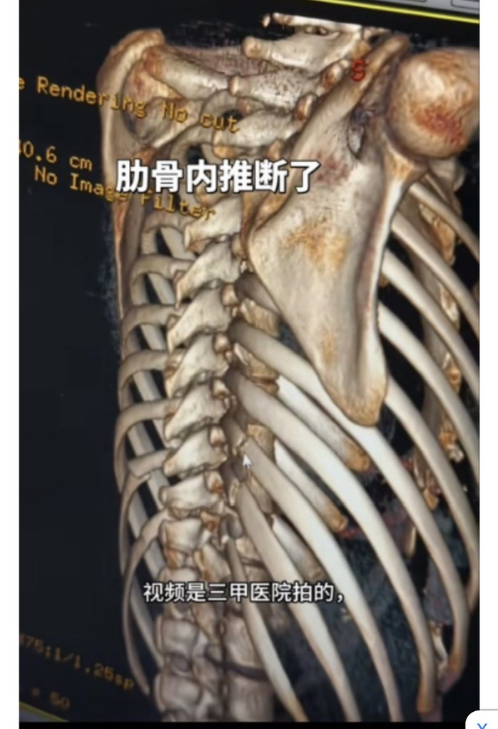 Xu hướng l&agrave;m đẹp kinh dị đang thịnh h&agrave;nh của mỹ nh&acirc;n - Ảnh 2.