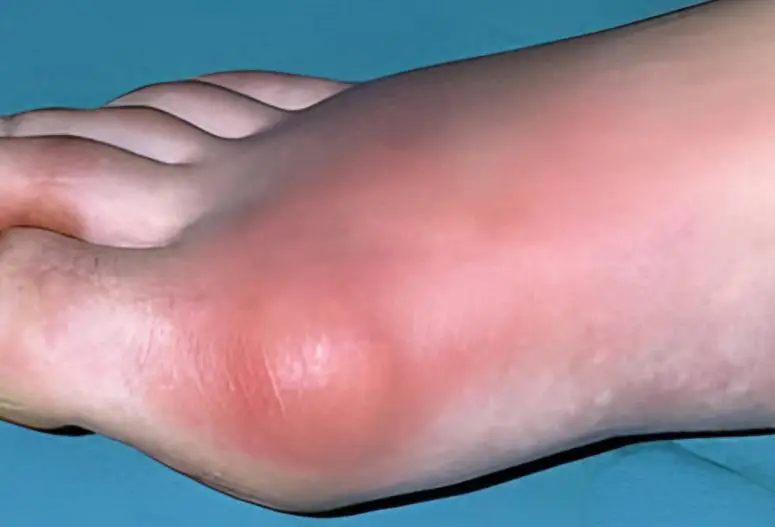 Người phụ nữ 40 tuổi uống nước đậu đen mỗi ng&agrave;y để &ldquo;thải độc&rdquo;: 2 năm sau đi kh&aacute;m, b&aacute;c sĩ n&oacute;i một c&acirc;u khiến ai cũng giật m&igrave;nh- Ảnh 3.