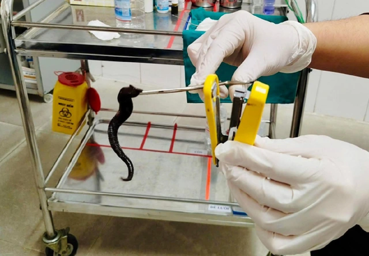 Đi kh&aacute;m, người đ&agrave;n &ocirc;ng sốc nặng khi thấy thứ đ&aacute;ng sợ trong mũi m&igrave;nh- Ảnh 1.