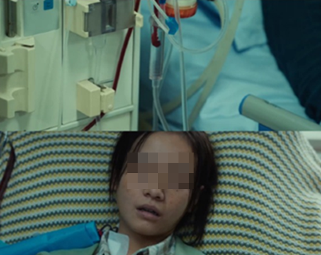 C&ocirc; g&aacute;i 29 tuổi chạy thận 2 năm mới b&agrave;ng ho&agrave;ng nhận ra: 10 dấu hiệu n&agrave;y thực chất l&agrave; tiếng &ldquo;k&ecirc;u cứu&rdquo; của thận- Ảnh 1.