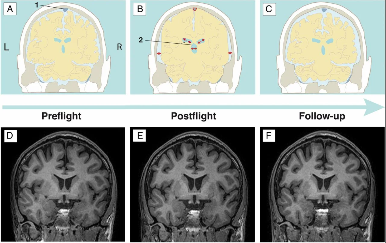 N&atilde;o phi h&agrave;nh gia 'biến dạng' sau thời gian tr&ecirc;n vũ trụ: Ảnh chụp h&eacute; lộ kh&aacute;c biệt n&agrave;y so với người thường- Ảnh 1.