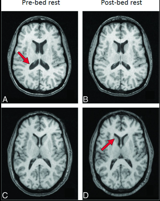 N&atilde;o phi h&agrave;nh gia 'biến dạng' sau thời gian tr&ecirc;n vũ trụ: Ảnh chụp h&eacute; lộ kh&aacute;c biệt n&agrave;y so với người thường- Ảnh 2.