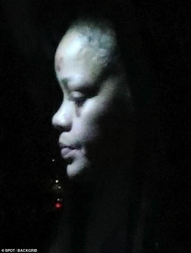 Đau gi&ugrave;m Rihanna- Ảnh 4.