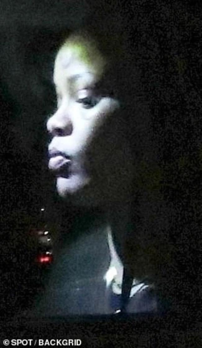 Đau gi&ugrave;m Rihanna- Ảnh 3.