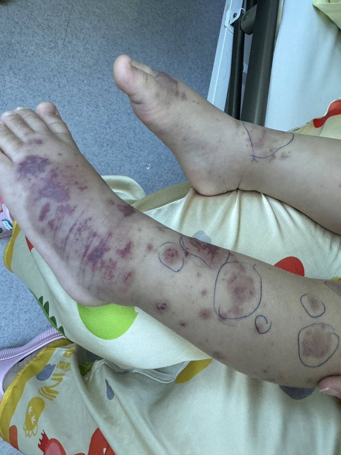 Chuy&ecirc;n gia cảnh b&aacute;o về một căn bệnh nguy hiểm, l&acirc;y lan nhanh, tỉ lệ tử vong cao- Ảnh 1.