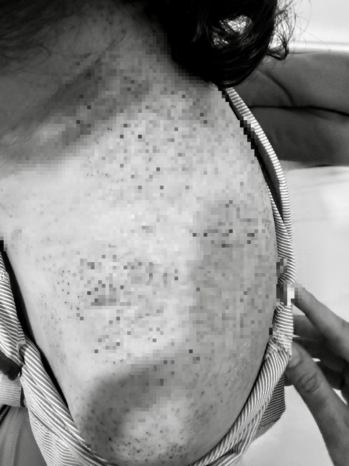 Người phụ nữ nhập viện cấp cứu sau khi ch&iacute;ch lể, gi&aacute;c hơi- Ảnh 2.