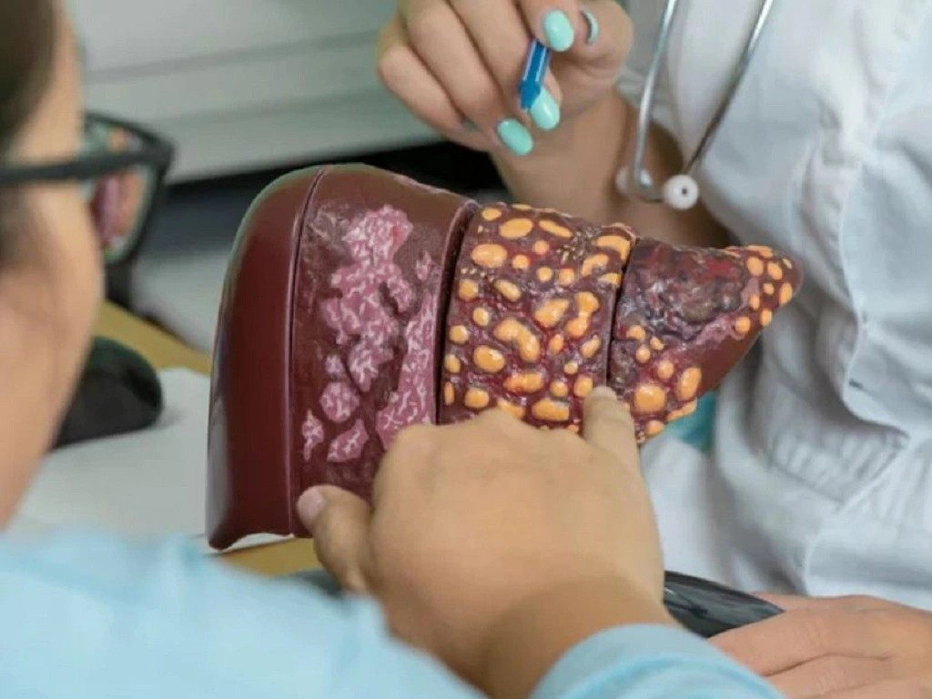 Kh&ocirc;ng phải thể dục, chỉ cần 1 thay đổi trong lối sống c&oacute; thể giảm 48% nguy cơ gan nhiễm mỡ, bệnh tim mạch v&agrave; tử vong sớm- Ảnh 1.