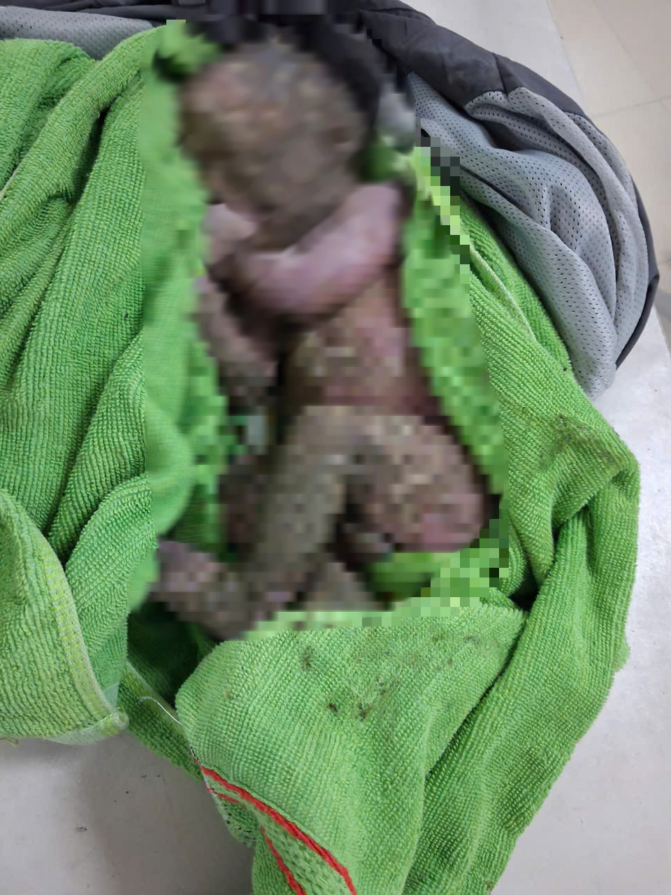 Cứu sống trẻ sơ sinh bị bỏ rơi đ&atilde; ngừng tim, người đầy b&ugrave;n đất- Ảnh 1.