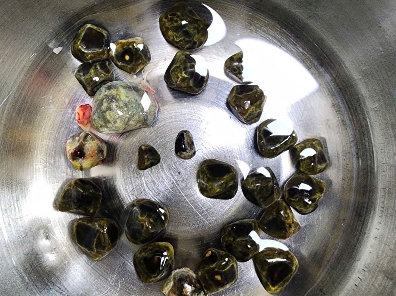 Người phụ nữ trẻ su&yacute;t mất mạng sau 3 ng&agrave;y tự điều trị đau bụng- Ảnh 3.