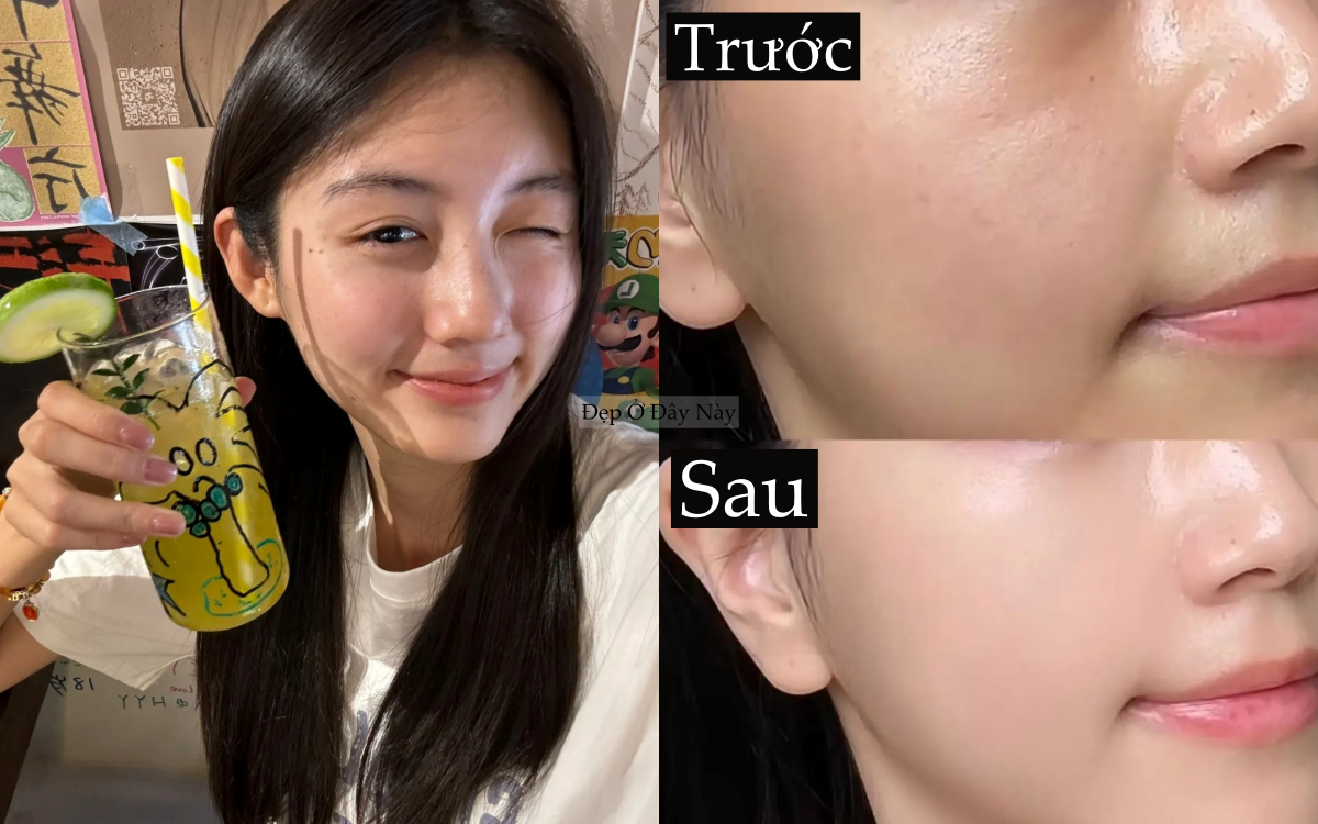 T&ocirc;i t&igrave;m ra c&aacute;ch dưỡng da căng b&oacute;ng ngậm nước m&agrave; kh&ocirc;ng cần tới spa- Ảnh 5.