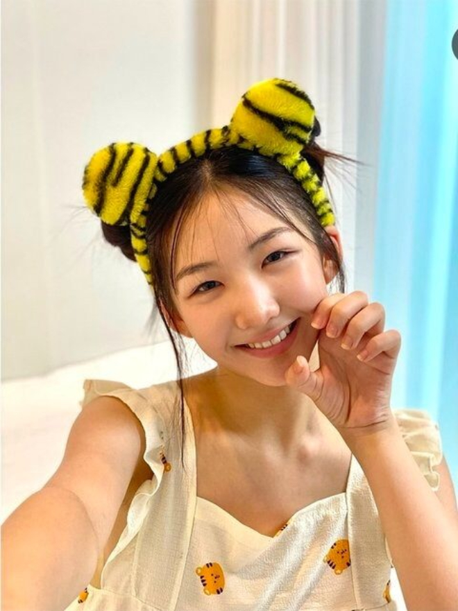 Sao nh&iacute; 15 tuổi &ldquo;dao k&eacute;o&rdquo; hỏng tới mức tự hủy nhan sắc- Ảnh 4.