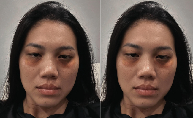 Dụi mắt không nhận ra Ánh Viên, sao lại ra nông nỗi này?- Ảnh 1. Dụi mắt không nhận ra Ánh Viên, sao lại ra nông nỗi này?- Ảnh 1.