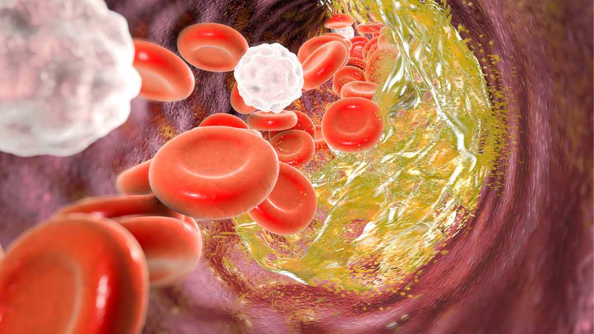 Ăn chuối đều đặn trong 6 th&aacute;ng, mức cholesterol trong cơ thể biến đổi bất ngờ- Ảnh 1.