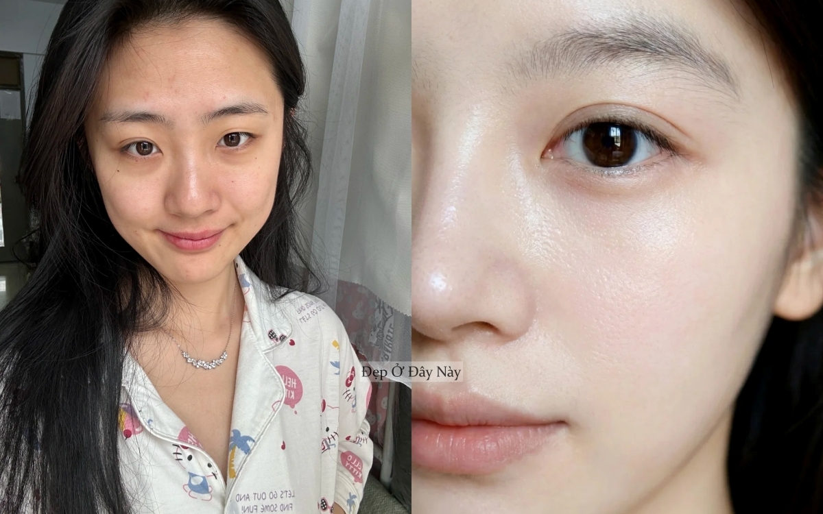 5 sai lầm dưỡng da dịp s&aacute;t Tết của nhiều chị em mắc khiến da "xuống dốc kh&ocirc;ng phanh"- Ảnh 4.