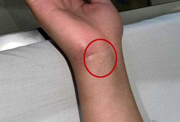 Bệnh viện Trung ương Qu&acirc;n đội 108 ph&aacute;t cảnh b&aacute;o về 1 căn bệnh nguy hiểm, nh&agrave; n&agrave;o cũng c&oacute; nguy cơ mầm mống tr&uacute; ngụ