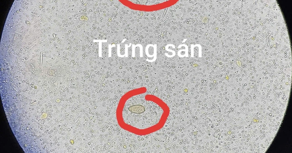 Đau bụng đi kh&aacute;m, người đ&agrave;n &ocirc;ng 64 tuổi sốc ngang khi thấy ở s&aacute;n trong người