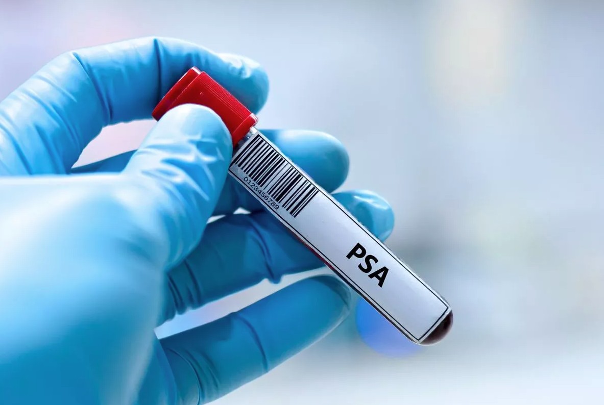 Bác sĩ cảnh báo trực tiếp nam giới về một loại ung thư đang gia tăng- Ảnh 1. Bác sĩ cảnh báo trực tiếp nam giới về một loại ung thư đang gia tăng- Ảnh 1.