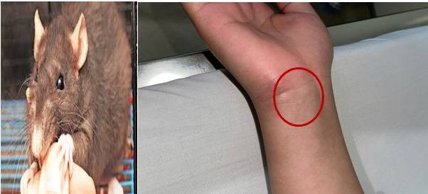 Bệnh viện Trung ương Quân đội 108 phát cảnh báo về 1 căn bệnh nguy hiểm, nhà nào cũng có nguy cơ mầm mống trú ngụ- Ảnh 2. Bệnh viện Trung ương Quân đội 108 phát cảnh báo về 1 căn bệnh nguy hiểm, nhà nào cũng có nguy cơ mầm mống trú ngụ- Ảnh 2.