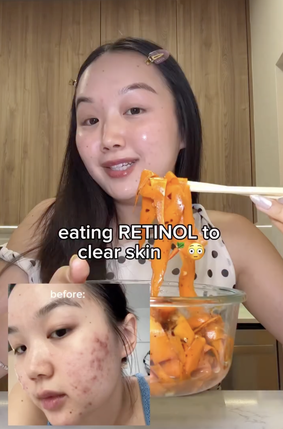 Bát salad 5’ tạo retinol dồi dào, mặt giảm hẳn mụn mà da vẫn lành- Ảnh 1. Bát salad 5’ tạo retinol dồi dào, mặt giảm hẳn mụn mà da vẫn lành- Ảnh 1.