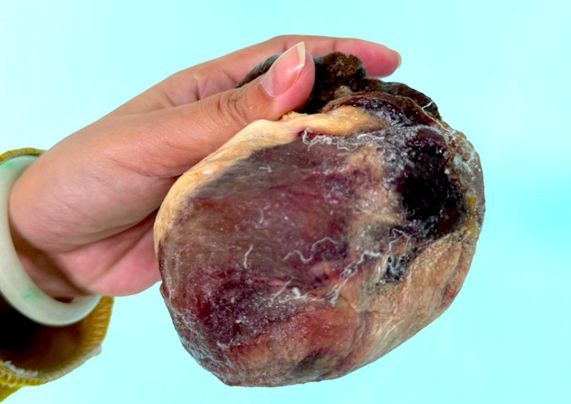 Mổ thịt con b&ograve; chỉ ngủ đứng, ph&aacute;t hiện vật thể nghi l&agrave; ngưu ho&agrave;ng qu&yacute; hiếm- Ảnh 1.