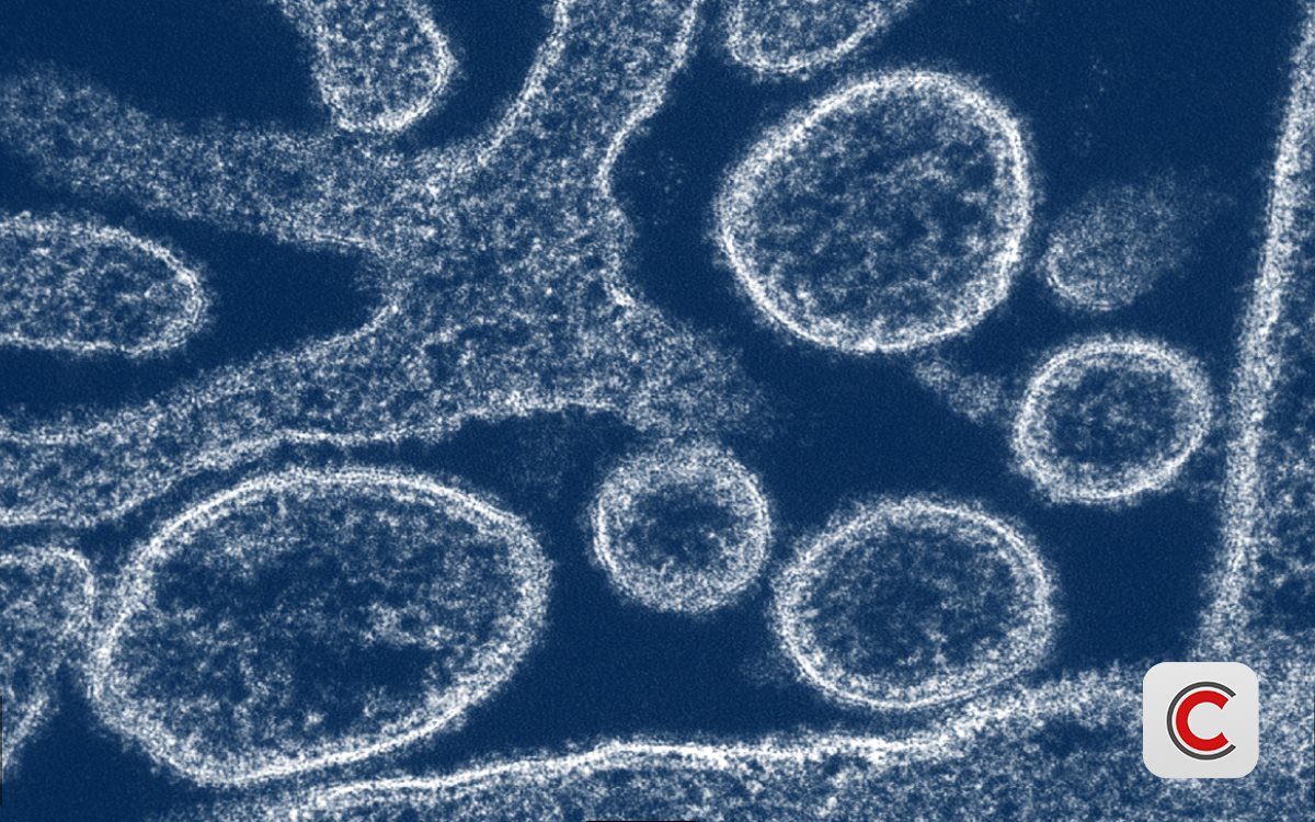 Nipah 2026: "S&aacute;t thủ" c&oacute; tỷ lệ tử vong 40-75%, chưa c&oacute; vaccine đặc hiệu- Ảnh 1.