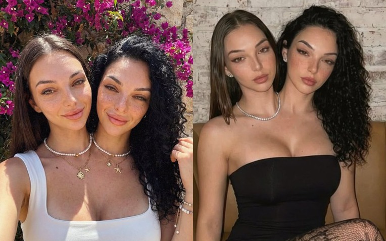 C&uacute; lừa ngoạn mục của kỷ nguy&ecirc;n số: Cặp song sinh d&iacute;nh liền "vạn người m&ecirc;" n&agrave;y thực chất l&agrave; sản phẩm của AI- Ảnh 1.