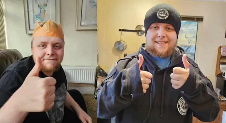 N&atilde;o ch&agrave;ng trai 24 tuổi gi&agrave; như người 70, b&aacute;c sĩ kh&ocirc;ng tin v&agrave;o kết quả chụp MRI- Ảnh 2.