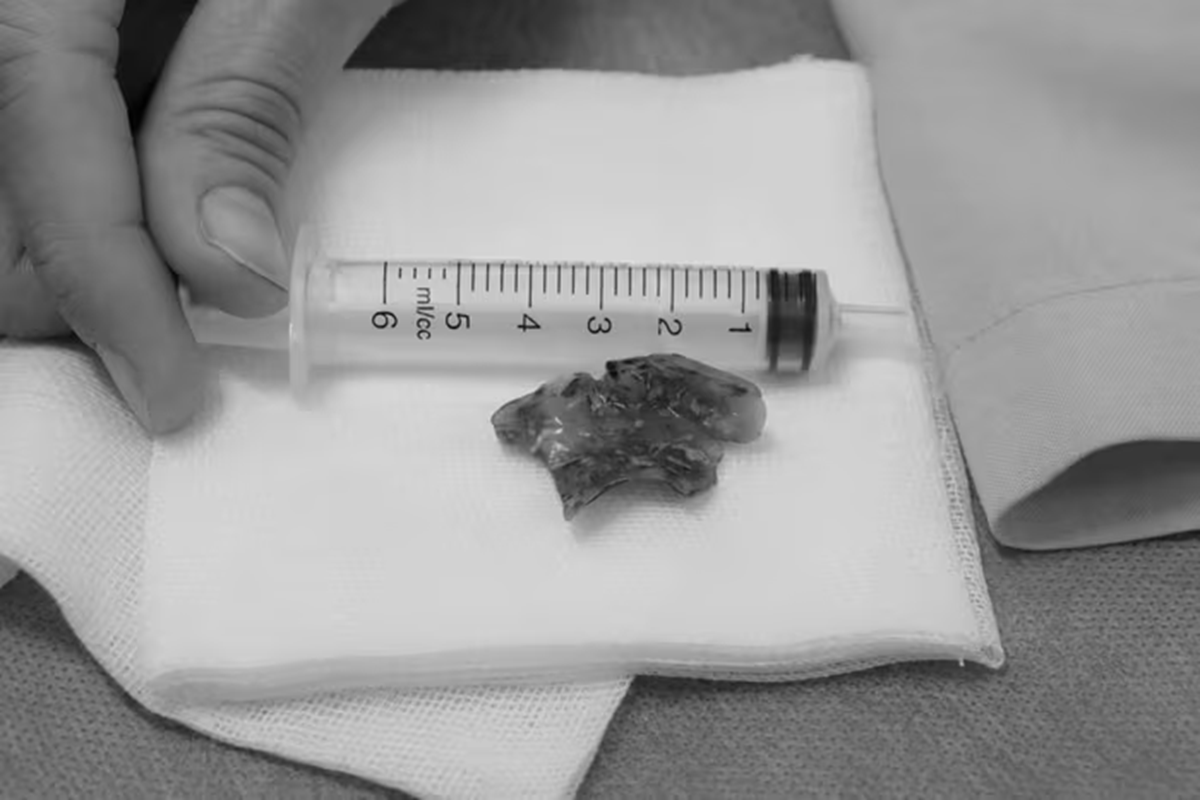 Nửa đ&ecirc;m đau họng, người phụ nữ 55 tuổi ph&aacute;t hiện b&iacute; mật "đ&aacute;ng sợ"- Ảnh 1.