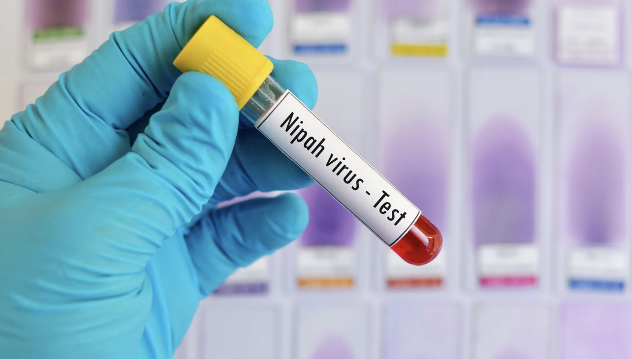 TPHCM tăng cường giám sát nhập cảnh, kiểm soát dịch bệnh Nipah- Ảnh 1. TPHCM tăng cường giám sát nhập cảnh, kiểm soát dịch bệnh Nipah- Ảnh 1.