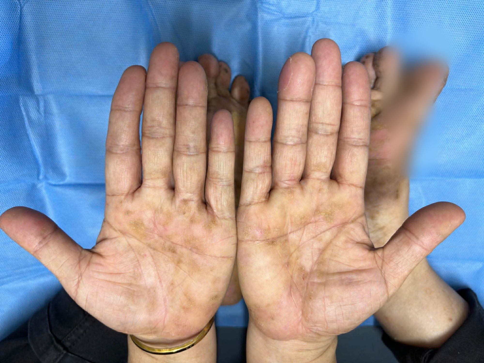 Da đỏ sậm, bong tr&oacute;c khi trời lạnh, người phụ nữ H&agrave; Nội phải cầu cứu b&aacute;c sĩ- Ảnh 1.