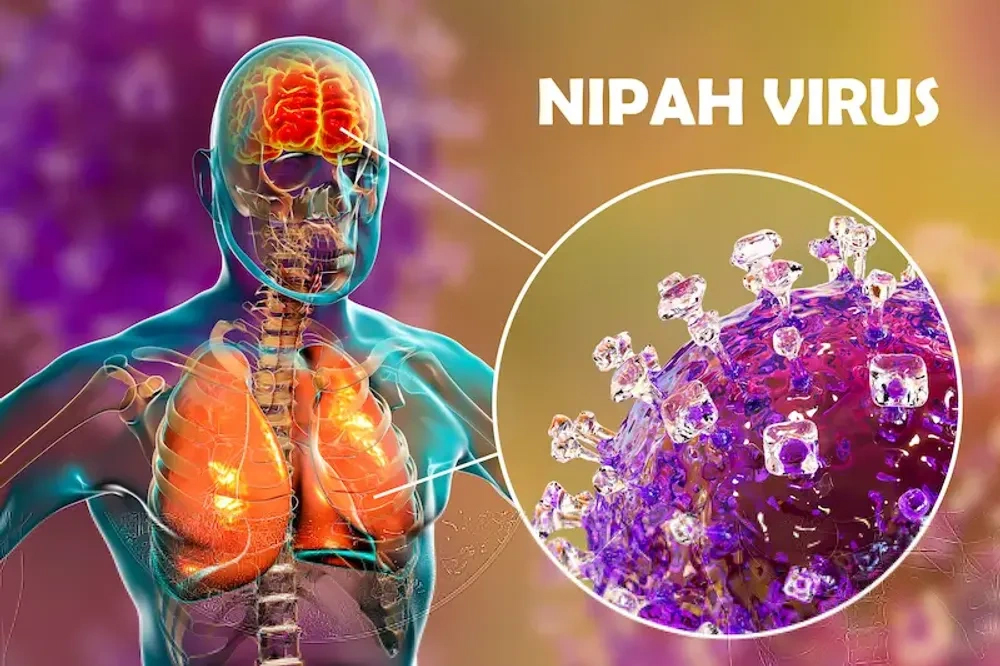 Virus Nipah quay trở lại Ấn Độ: Giới chuyên gia nói gì về nguy cơ xâm nhập Việt Nam?- Ảnh 1. Virus Nipah quay trở lại Ấn Độ: Giới chuyên gia nói gì về nguy cơ xâm nhập Việt Nam?- Ảnh 1.