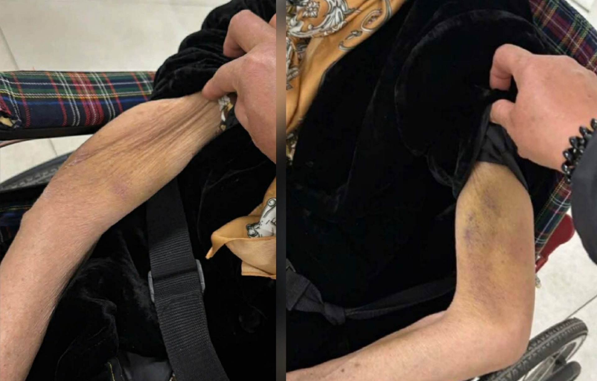 Vụ cụ b&agrave; 82 tuổi ở H&agrave; Nội nghi bị bạo h&agrave;nh: Điều bất thường của nữ gi&uacute;p việc 47 tuổi- Ảnh 2.