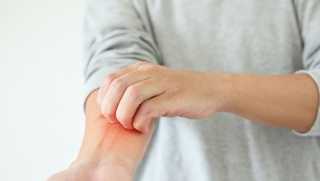 Người đ&agrave;n &ocirc;ng 40 tuổi ph&aacute;t hiện ung thư gan giai đoạn cuối: Đ&aacute;ng tiếc &ocirc;ng đ&atilde; bỏ qua dấu hiệu suốt 3 th&aacute;ng- Ảnh 1.