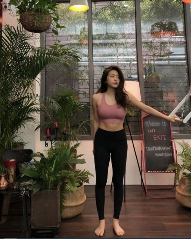 Nữ idol g&atilde;y cổ v&igrave; tập pilates- Ảnh 5.