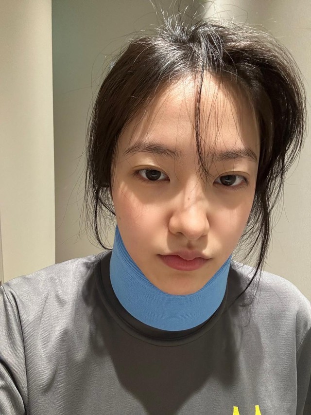 Nữ idol g&atilde;y cổ v&igrave; tập pilates- Ảnh 1.