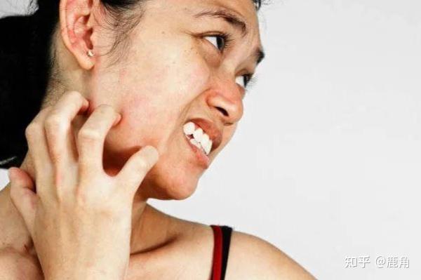 Người đ&agrave;n &ocirc;ng 40 tuổi ph&aacute;t hiện ung thư gan giai đoạn cuối: Đ&aacute;ng tiếc &ocirc;ng đ&atilde; bỏ qua dấu hiệu suốt 3 th&aacute;ng- Ảnh 3.