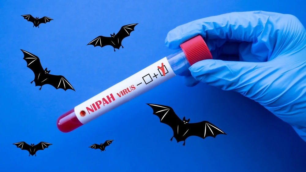 B&aacute;c sĩ bệnh viện tuyến đầu n&oacute;i thẳng về virus Nipah- Ảnh 4.