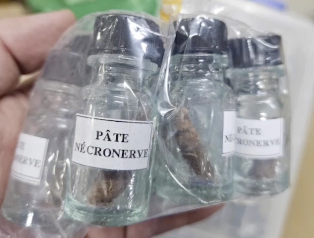 Vụ bắt hơn 3.000 thuốc nha khoa chứa thạch tín: Giám đốc bệnh viện cảnh báo nguy cơ hoại tử xương hàm- Ảnh 2. Vụ bắt hơn 3.000 thuốc nha khoa chứa thạch tín: Giám đốc bệnh viện cảnh báo nguy cơ hoại tử xương hàm- Ảnh 2.