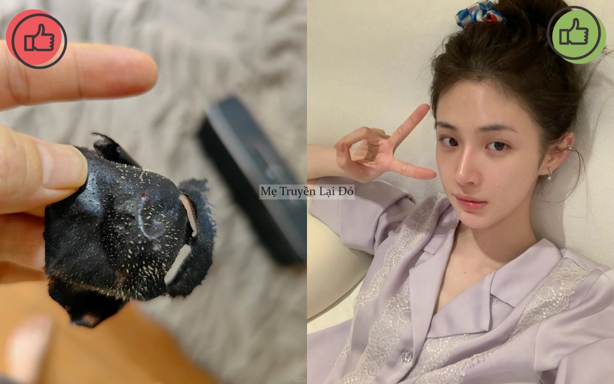 Mẹ t&ocirc;i từng mua đủ thứ để chăm da, b&agrave; bảo t&ocirc;i rằng c&oacute; 5 m&oacute;n kh&ocirc;ng n&ecirc;n d&ugrave;ng v&igrave; sẽ khiến da xấu đi- Ảnh 1.