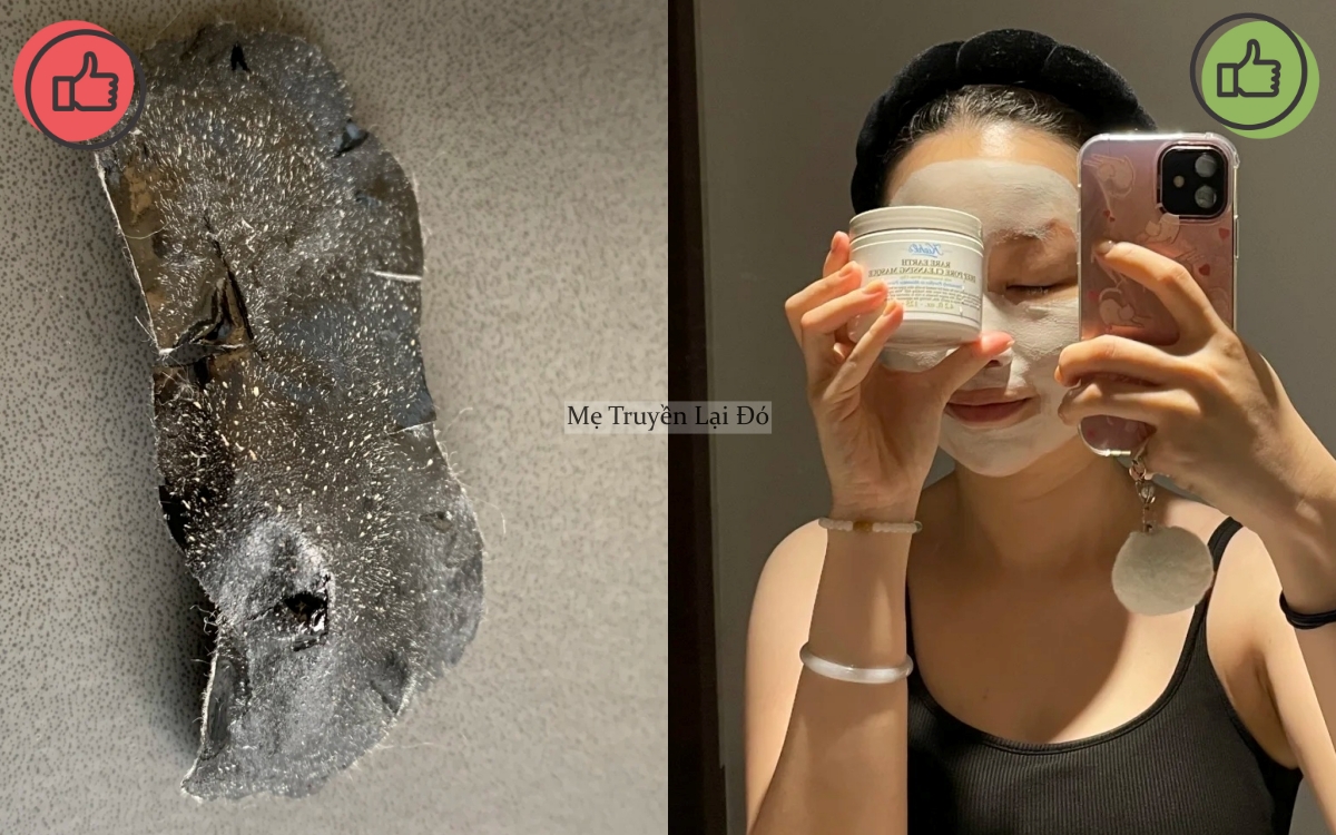 Mẹ t&ocirc;i từng mua đủ thứ để chăm da, b&agrave; bảo t&ocirc;i rằng c&oacute; 5 m&oacute;n kh&ocirc;ng n&ecirc;n d&ugrave;ng v&igrave; sẽ khiến da xấu đi- Ảnh 3.