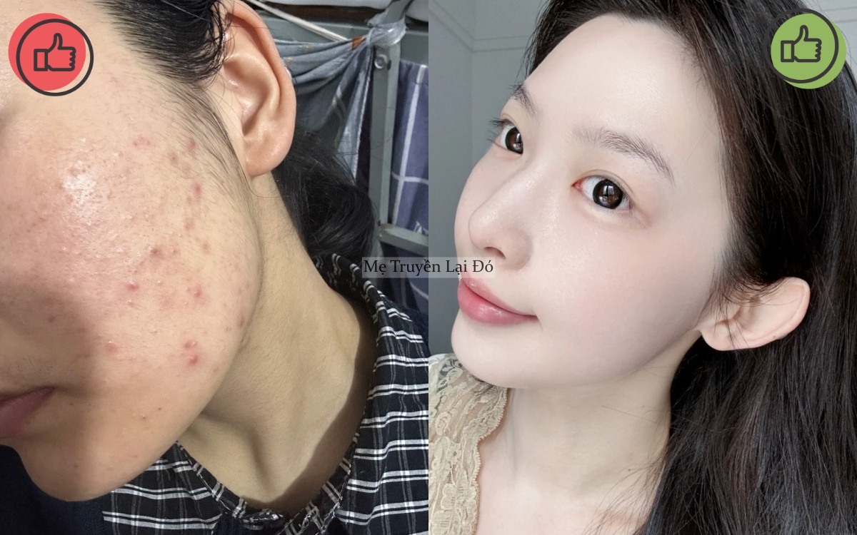 Mẹ t&ocirc;i từng mua đủ thứ để chăm da, b&agrave; bảo t&ocirc;i rằng c&oacute; 5 m&oacute;n kh&ocirc;ng n&ecirc;n d&ugrave;ng v&igrave; sẽ khiến da xấu đi- Ảnh 6.