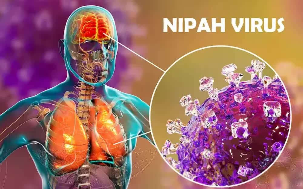 Infographic: C&aacute;c biện ph&aacute;p ph&ograve;ng, chống dịch bệnh do virus Nipah- Ảnh 1.